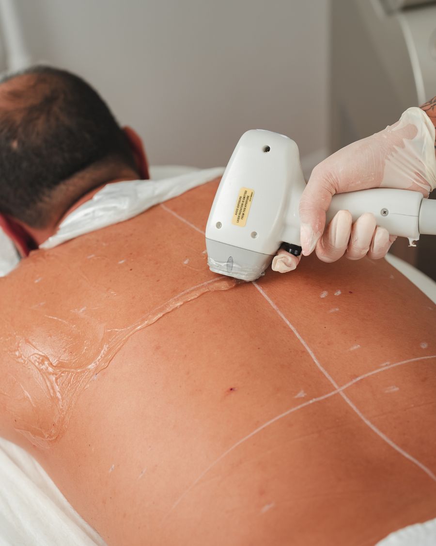 Laser treatment session in a clinical setting