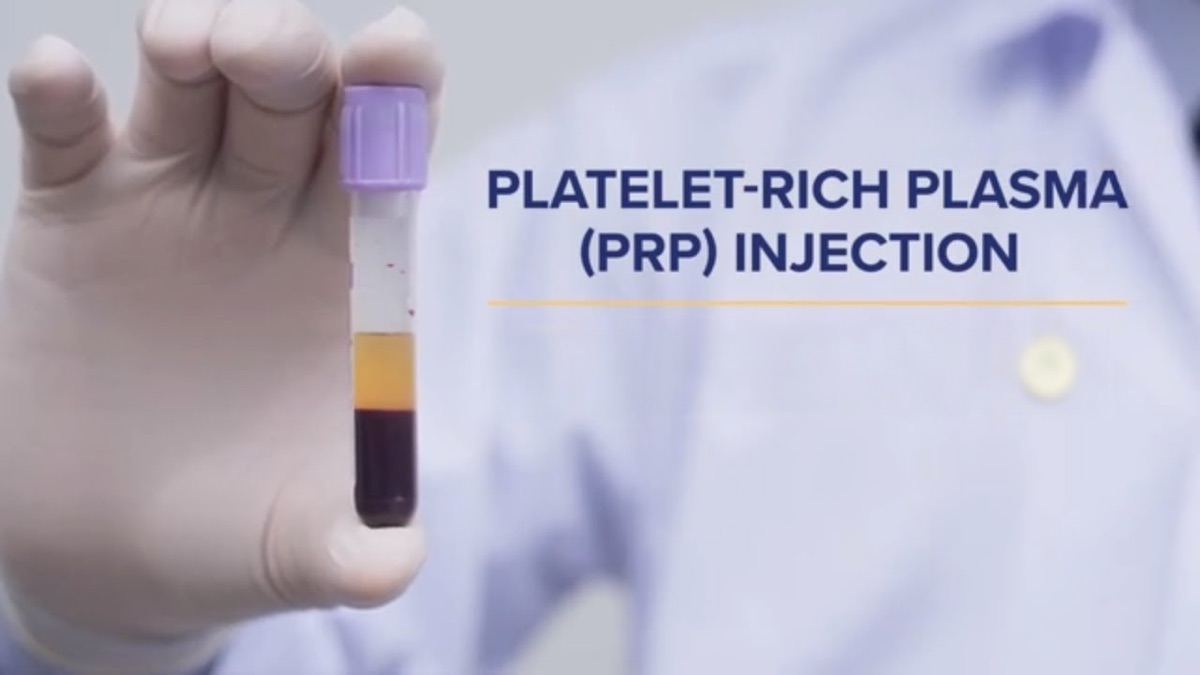 Platelet-rich plasma (PRP) vial